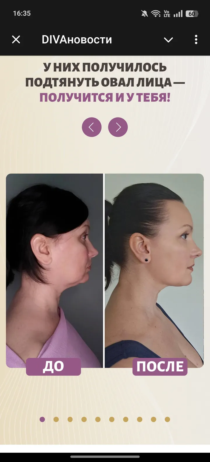 DIVA - школа омоложения — Screenshot 4