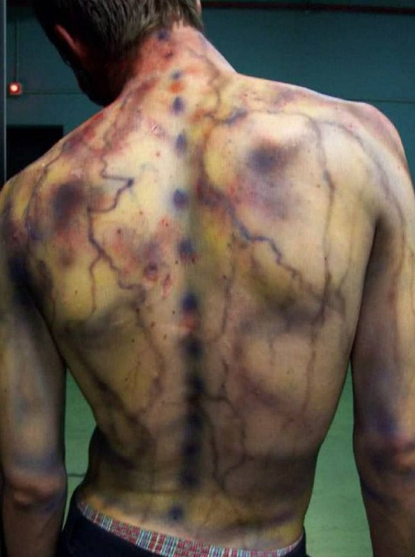 Lightning strike marks are a unique phenomenon.  The electric discharge pushe...