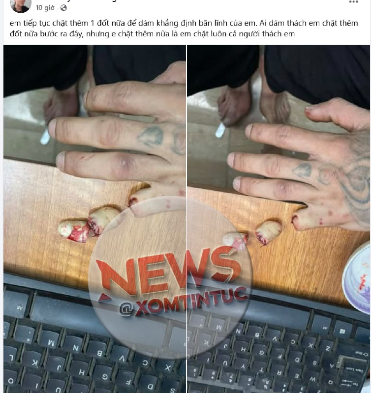 1 THANH NIÊN TẠI THANH HÓA CH.ẶT ĐỨT NGÓN TAY ÚT CỦA MÌNH ĐỂ CẢNH BÁO CÁC CON...