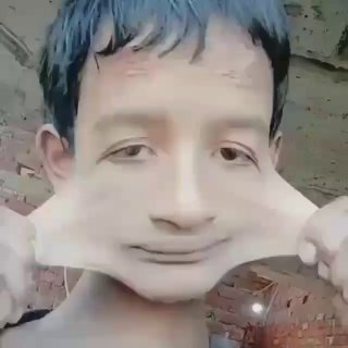 Синдром Элерса-Данлоса.   Это наследственный порок развития соединительной тк...