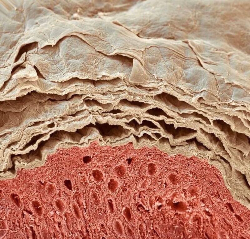 Наша кожа под микроскопом.