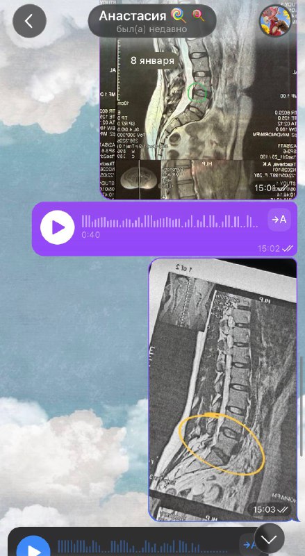 ну что ж, это случилось  сделала вчера МРТ поясничного отдела и сходила к нев...
