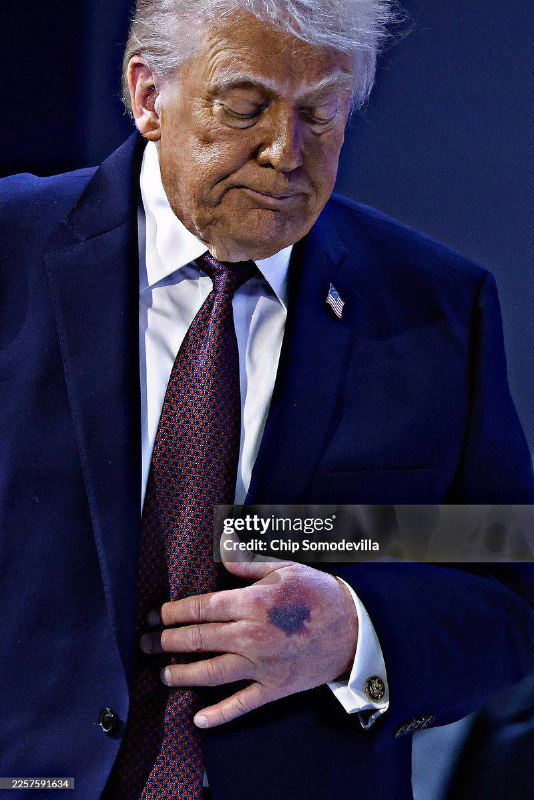 Злые языки говорят, что сегодня за кулисами Давоса лидеры стран, подписавших ...