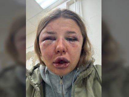 «Как можно вот таких ребят выпускать за пределы Дагестана? Человека делают ин...